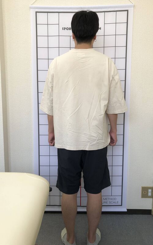 ビフォー