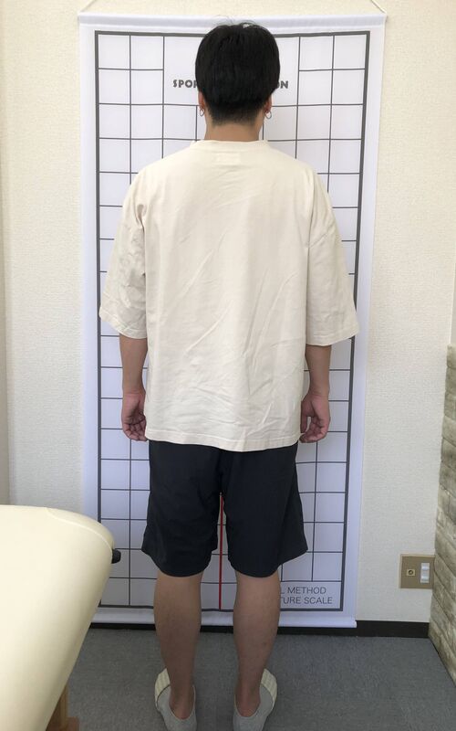 アフター